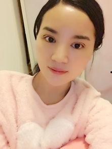 明星抽眼脂,抽眼脂术，揭秘眼部年轻化的秘密武器